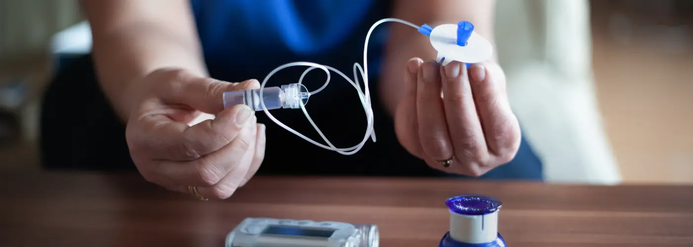 مضخة الإنسولين_ طريقة عملها، مميزاتها، وتحديات استخدامها